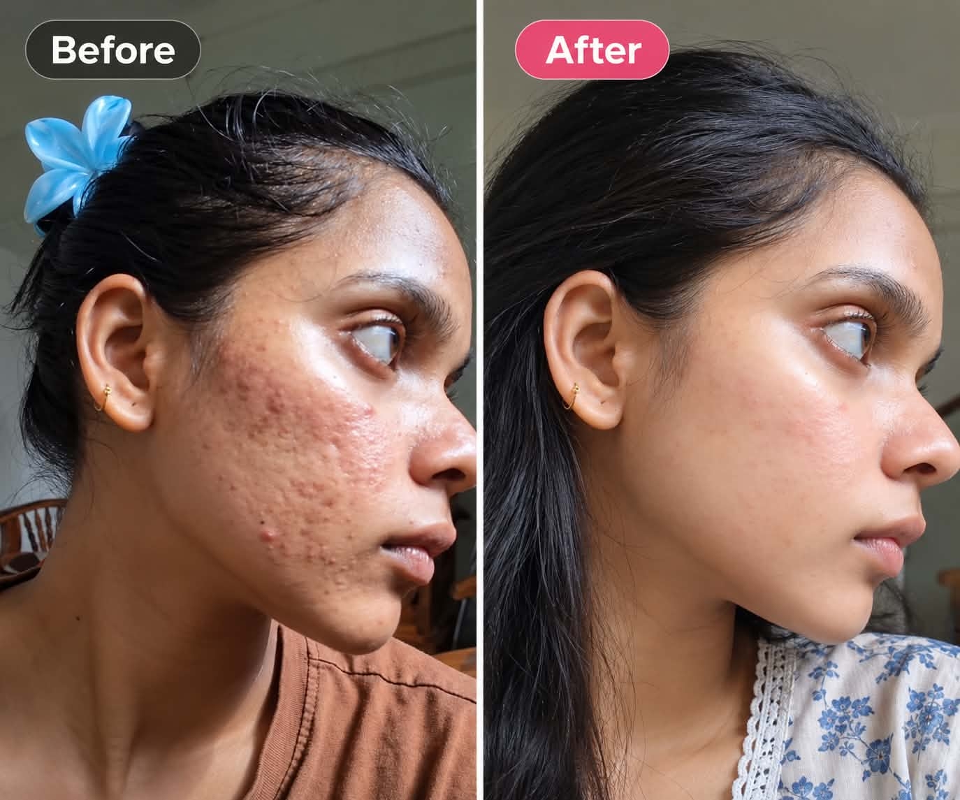 গ্রাহকের ফলাফল 2 — আগে ও পরে