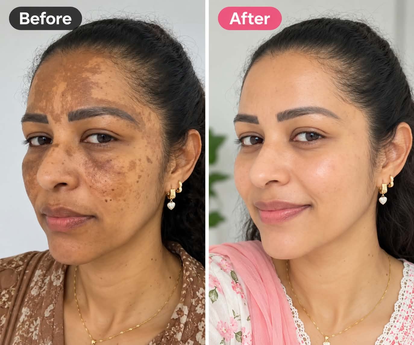 গ্রাহকের ফলাফল 4 — আগে ও পরে